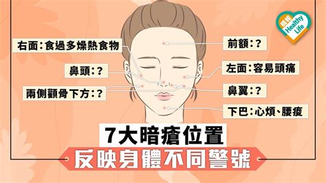 下巴 生 暗瘡|【暗瘡位置】不同代表什麼？中醫教如何處理及預防